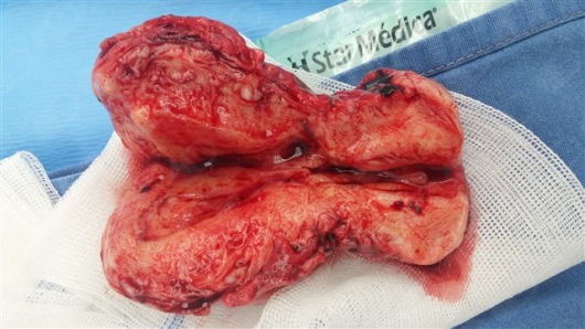 María José Chiriboga Zambrano-11