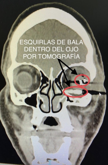 Norma Evelia Pichardo Sotelo-7