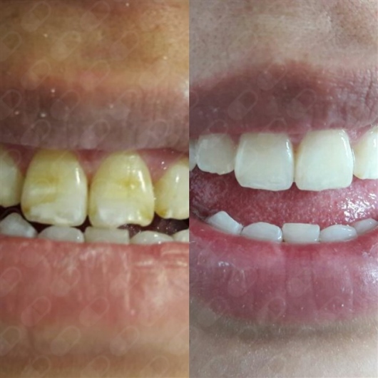 Flor Angélica Delgado De Alba-2