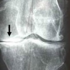 Dr. Emilio González Rosas