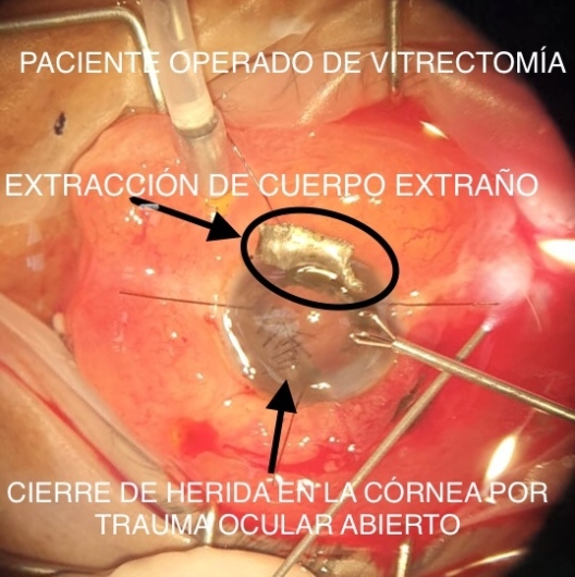 Norma Evelia Pichardo Sotelo-15