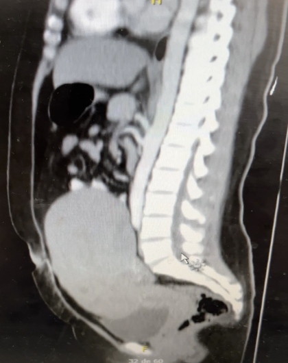 Carlos Daniel Macias Ochoa-10