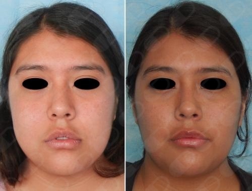 José Antonio García Piña-6