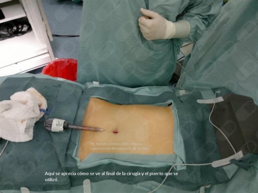 Rafael Contreras Ruíz De Velasco-2