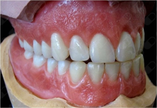 Gerardo Padrón Lagunes-14