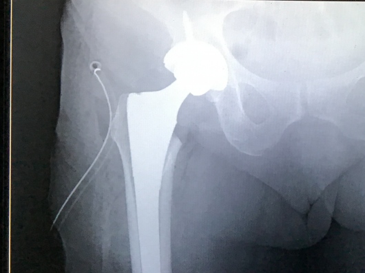 Josué Jonatan Arcia Guzmán-1