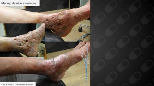 Carlos Mario Garcidueñas Briceño-13