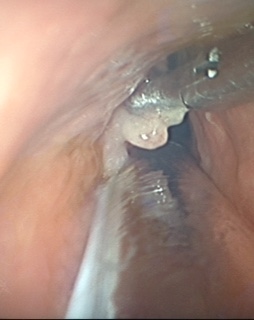 Eduardo Ivan Acuña Ramirez-11