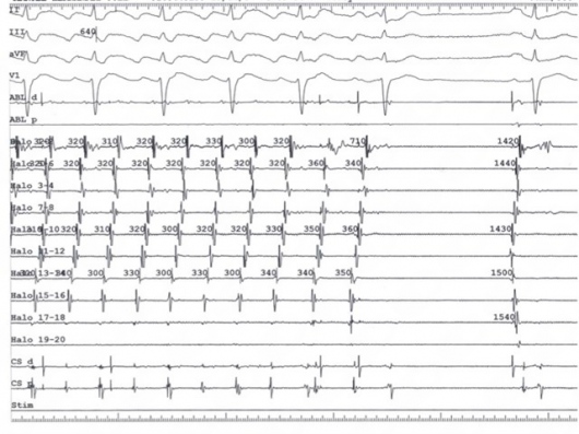 Alex Daniel Pacheco Bouthillier-4
