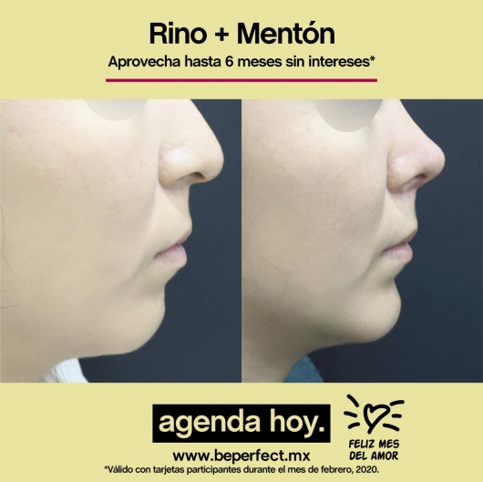 Lenin Alfonso Reyes Ibarra-48