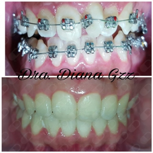 Diana Isabel González Bárcenas-11