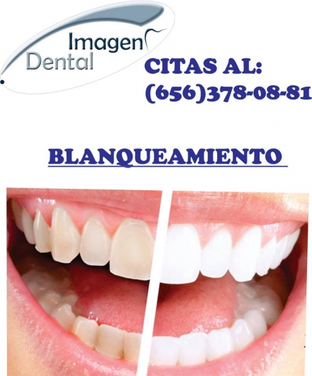 Leonel Palma Carlos-20