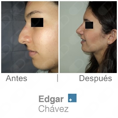 Edgar Chávez Oseguera-1