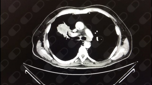 Lissette Quintana Arroyo-4