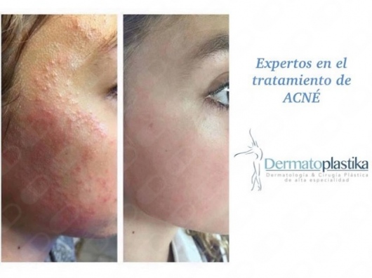 Hilda Carrillo Meléndrez-9