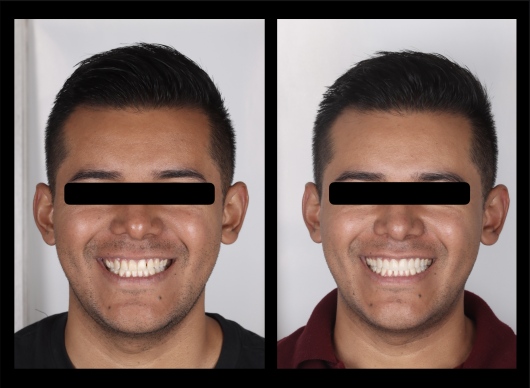 Dilan González Castrejon-0