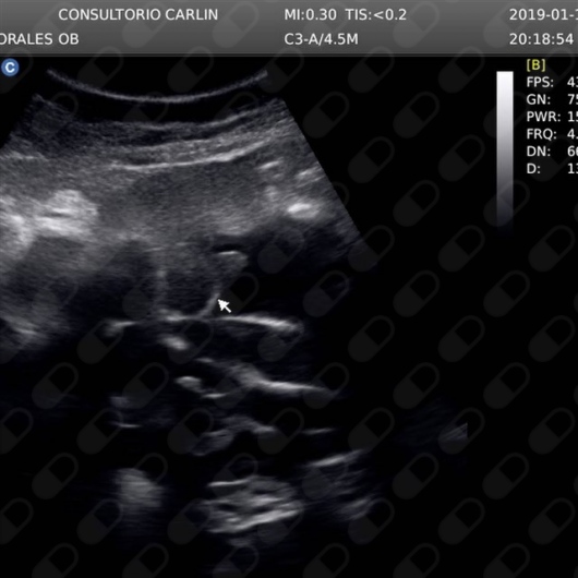 Nicolás Carlín Meza-4