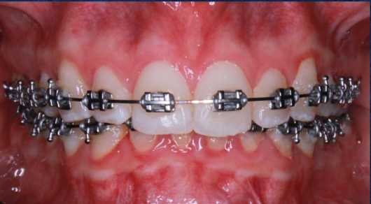 Uriel Alvarado Castillo-4