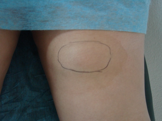 Orieta Herbas Rocha-5