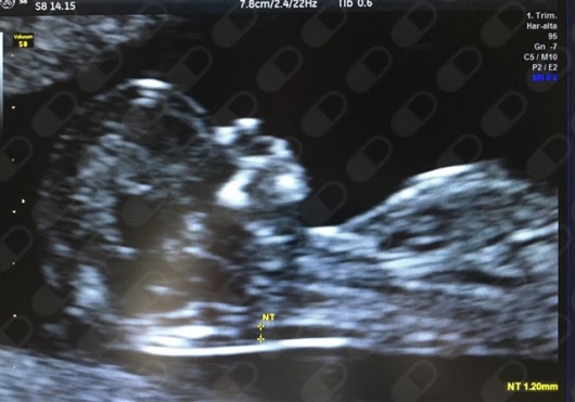 Gustavo Castillejo Torres-3