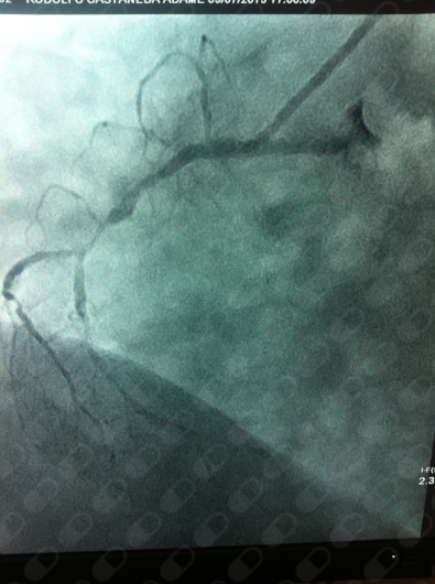 Carlos Alberto Becerra Laguna-7