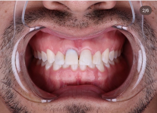 Alexandro Castrellon-3