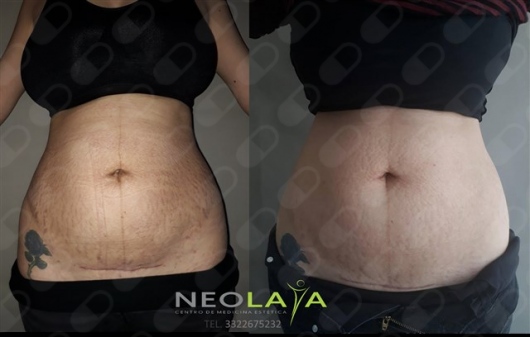 Xochitl Andrea Avalos Alvarez-20