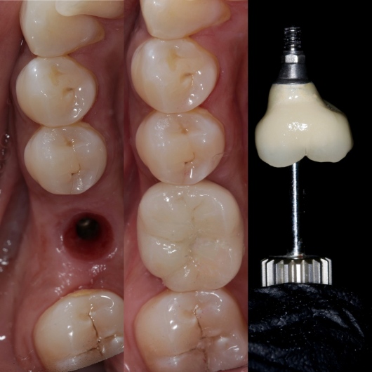 Hugo Moran Negrete-9