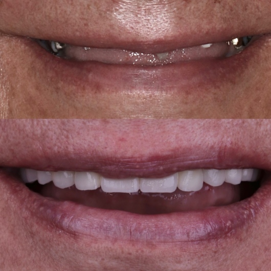 Hugo Moran Negrete-16