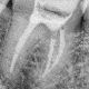 José Rubén Durán Molina