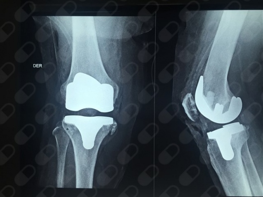 Jorge Salvador De La Cruz Alvarez-10