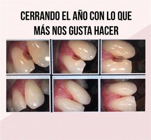 Alejandro Uribe Marioni-12