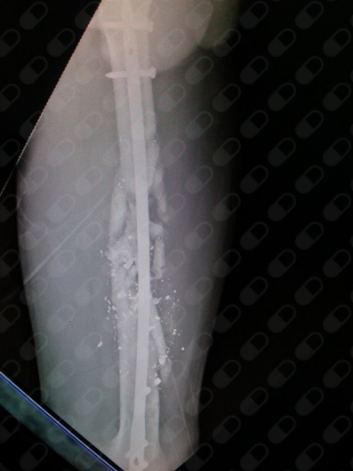 Jose Octavio Andrade Cruz-5