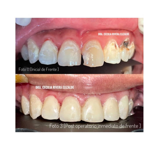 Cecilia Rivera Elizalde-6