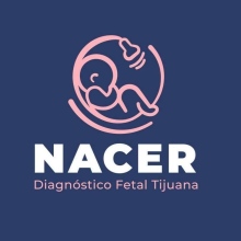 NACER