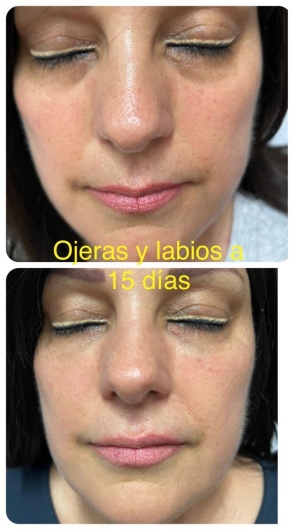 Arturo Romero Grande-15