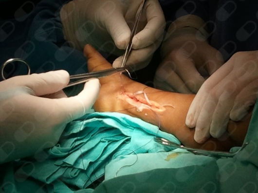 Hugo B. Torrano Orduña-5