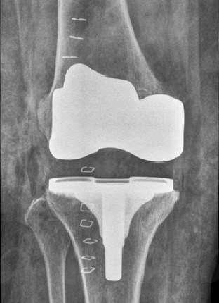Germán Angel Cubedo Liboy-10