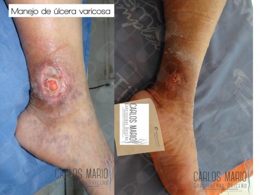 Carlos Mario Garcidueñas Briceño-8