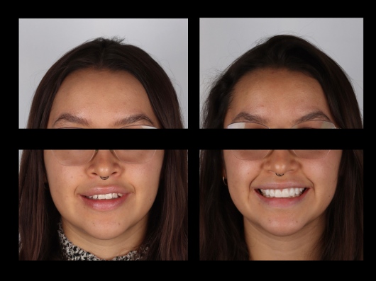 Dilan González Castrejon-19