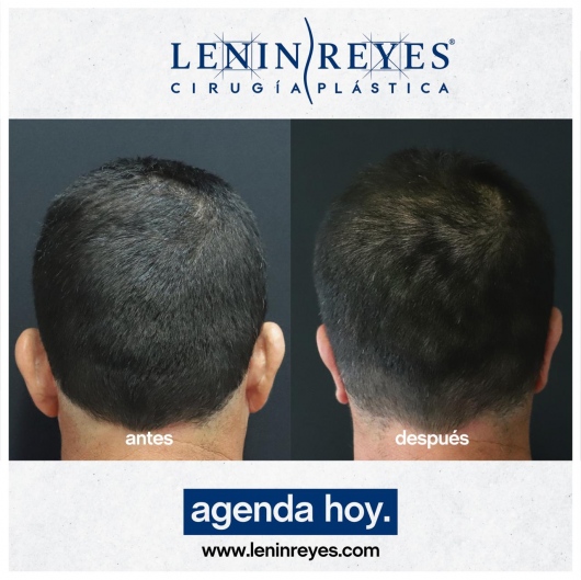 Lenin Alfonso Reyes Ibarra-47
