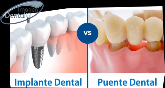 Leonel Palma Carlos-10