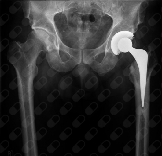 Heber Esteban Avitia Sámano-4