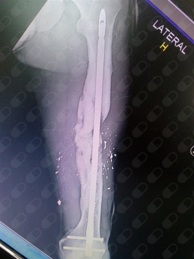 Jose Octavio Andrade Cruz-3