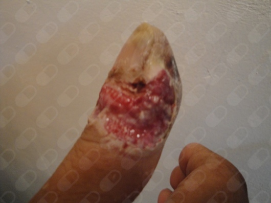 Angel Manuel Piña Jaén-0