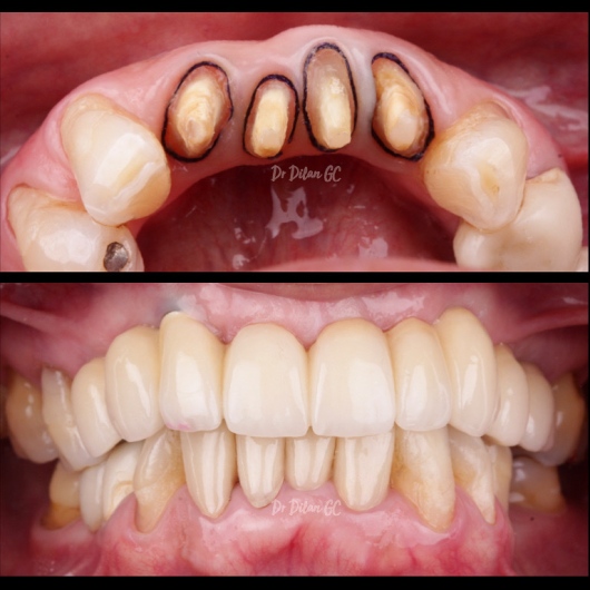 Dilan González Castrejon-22