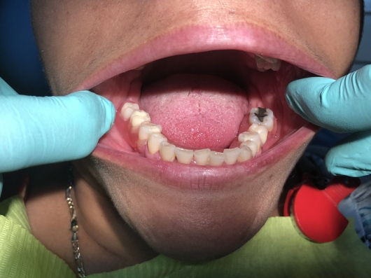 Arturo Romero Grande-37