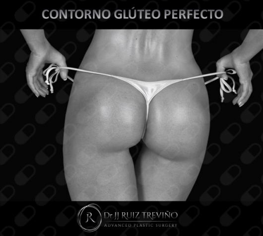 Juan José Ruiz Treviño-8