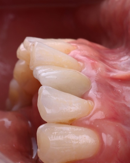 Dilan González Castrejon-15