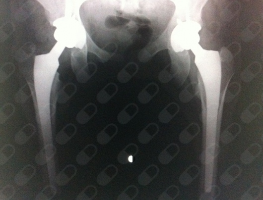 Enrique López Hernández-28